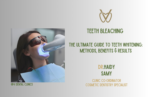 The Ultimate Guide to Teeth Whitening: Methods, Benefits & Results