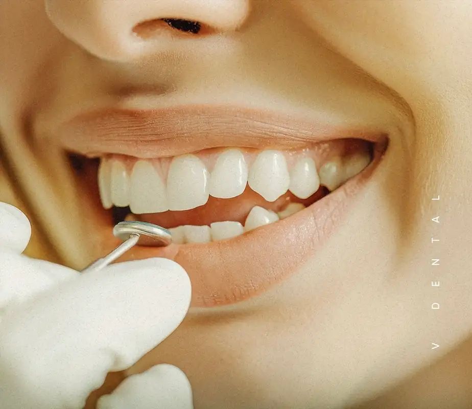 v-Dental Clinic